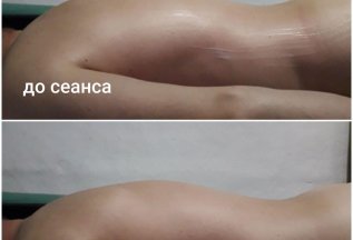 Первый прием со скидкой 50%