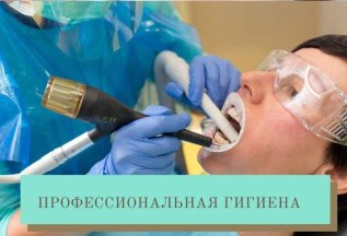 Профессиональная чистка зубов