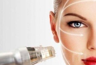 Новинка! Микроигольчатый RF-лифтинг -20% на первое посещение