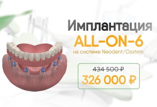 -108 тыс. на имплантацию ₽
