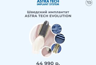 Акция на имплантат Astra Evolution (Швеция) за 43990 руб.