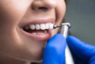 20% на профессиональную гигиену полости рта в День Рождения
