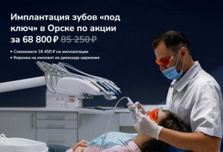 Имплантация зубов «под ключ» в Орске по акции за 68 800 ₽