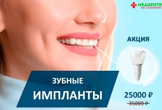 Установка зубных имплантов Osstem и Dentium