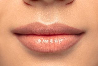 Контурная пластика Sofiderm Deep по специальной цене