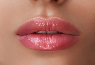 Контурная пластика Hyaluform Lips по специальной цене