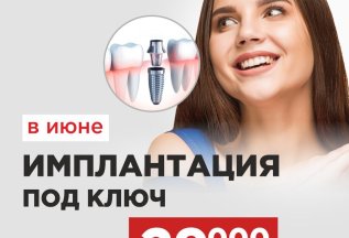 ИМПЛАНТАЦИЯ