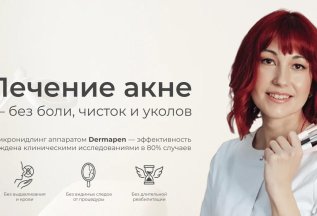 Лечение акне без выдавливания