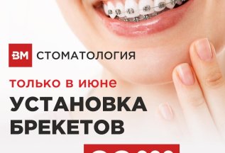 БРЕКЕТЫ