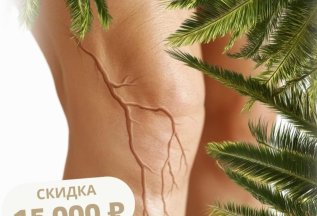 Скидка 15 000 рублей на лечение варикоза !