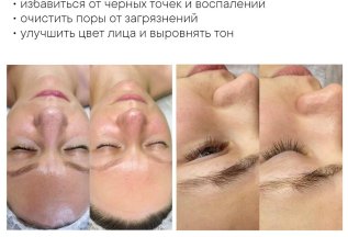 Летний детокс кожи: Чистка лица - минус 1000р весь июнь!