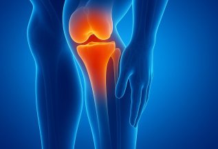 Биоимплант Bio-osteo коленного сустава (15% скидка!) от 59 ₽