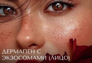 Дермапен с экзосомами