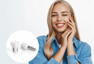 Специальная цена на зубные имплантаты - 44500 рублей!
