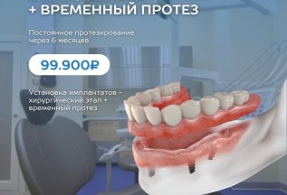 Имплантация зубов на 4 имплантатах+ протез за 99900