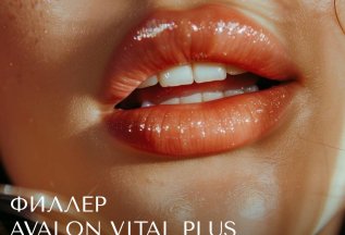 Филлер Avalon Vital plus