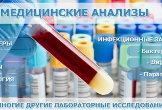 ЛАБОРАТОРНЫЕ ИССЛЕДОВАНИЯ
