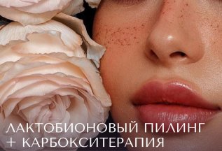 Лактобионовый пилинг + карбокситерапия