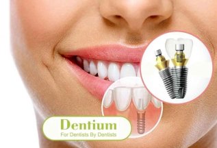 Имплантация Dentium SuperLine за 18000 рублей до 1.08.2025