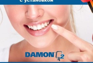 Брекет система