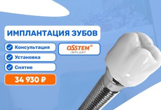 Имплантация зубов Система Osstem за 34 930 руб