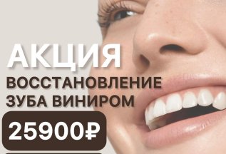 Восстановление зуба виниром 25900 руб