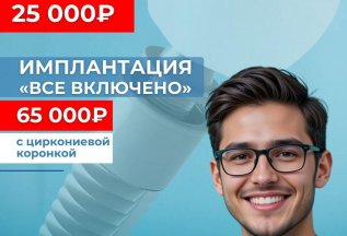 Имплантация