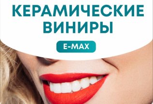 Керамические виниры E-MAX