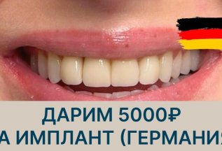 Дарим 5000₽ на имлант из Германии