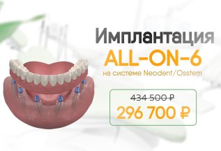 -137 тыс. на имплантацию ₽