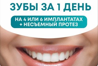 Зубы за 1 день