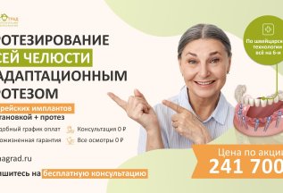 Протезирование всей челюсти на 6 имплантах