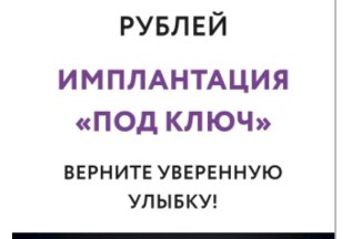Имплантация под ключ