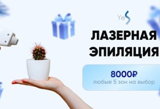Лазерная эпиляция