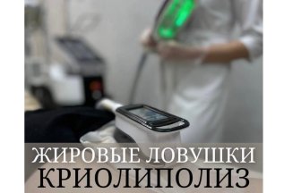 Криолиполиз