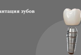 Имплантация зубов от 25000 руб