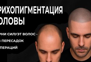 Трихопигментация SMP всего за 7000р!
