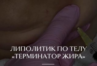 Липолитики