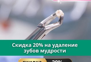 -20% на удаление зуба мудрости