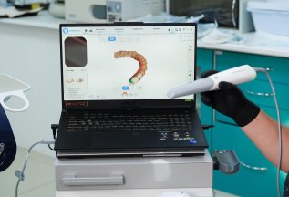 Установка имплантата Osstem - 25000 руб.