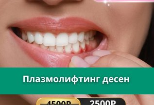 Плазмолифтинг десен