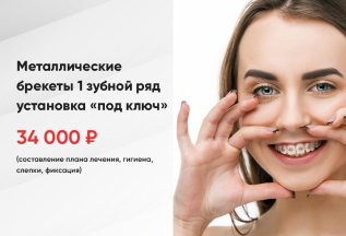 Металлические брекеты 1 зубной ряд установка «под ключ»