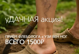 уДачная акция: приём флеболога + УЗИ вен ног за 1500 рублей