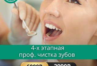 4-х этапная профессиональная гигиена рта и зубов