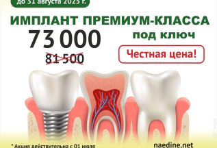 Акция «Имплантация под ключ»