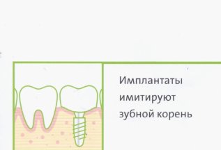 Имплантат STRAUMANN от 63 000 руб.
