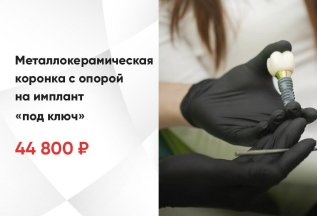 Металлокерамическая коронка с опорой на имплант «под ключ»