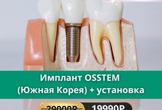 OSSTEM IMPLANT (Южная Корея) + установка