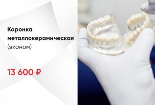 Коронка металлокерамическая (эконом)