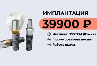 Имплантация Osstem - 39900 ₽